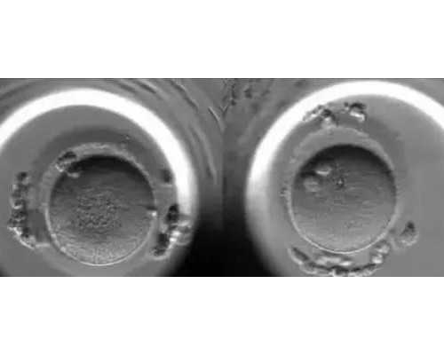 曼省移民 外省学生（加拿大曼省亲友担保移民申请流程）