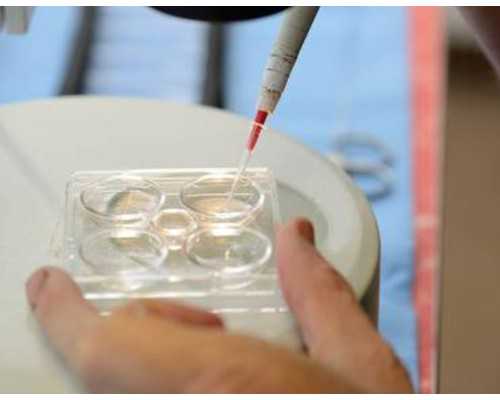 加拿大读康复专业移民（加拿大联邦移民详细情况介绍）