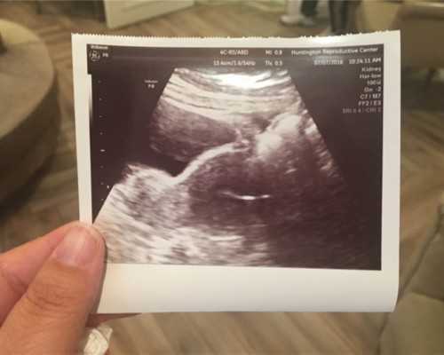 新西兰移民体检项目{新西兰2019移民新配额出炉！今年还有3至4万PR等你来拿！