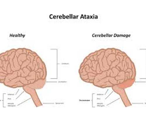 新西兰和加拿大移民（加拿大移民新政发布选好专业利于就业）