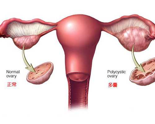 移民 美国 还是加拿大{加拿大绿卡和入籍有什么区别？}