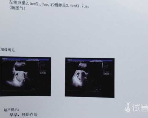 加拿大技术移民新政策{虽然气候较为寒冷，但是依旧不会阻挡吴女士移民加拿