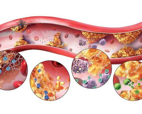 加拿大曼省移民项目（利好消息，2020年加拿大父母团聚移民即将开放）