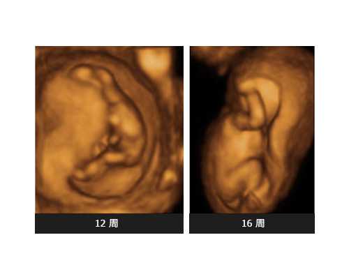 安省 魁北克 移民【加拿大魁北克教育体系，带孩子去蒙特利尔上学必读】